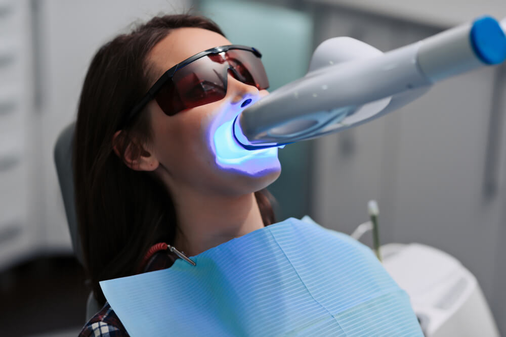Halfway Dental House Teeth Whitening Image